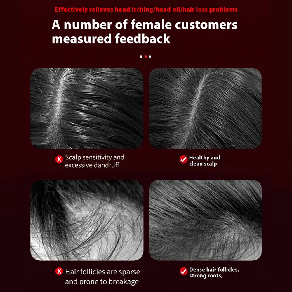 Scalp Therapy Massage