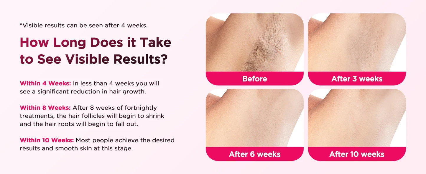 LumiSkin Hair Removal