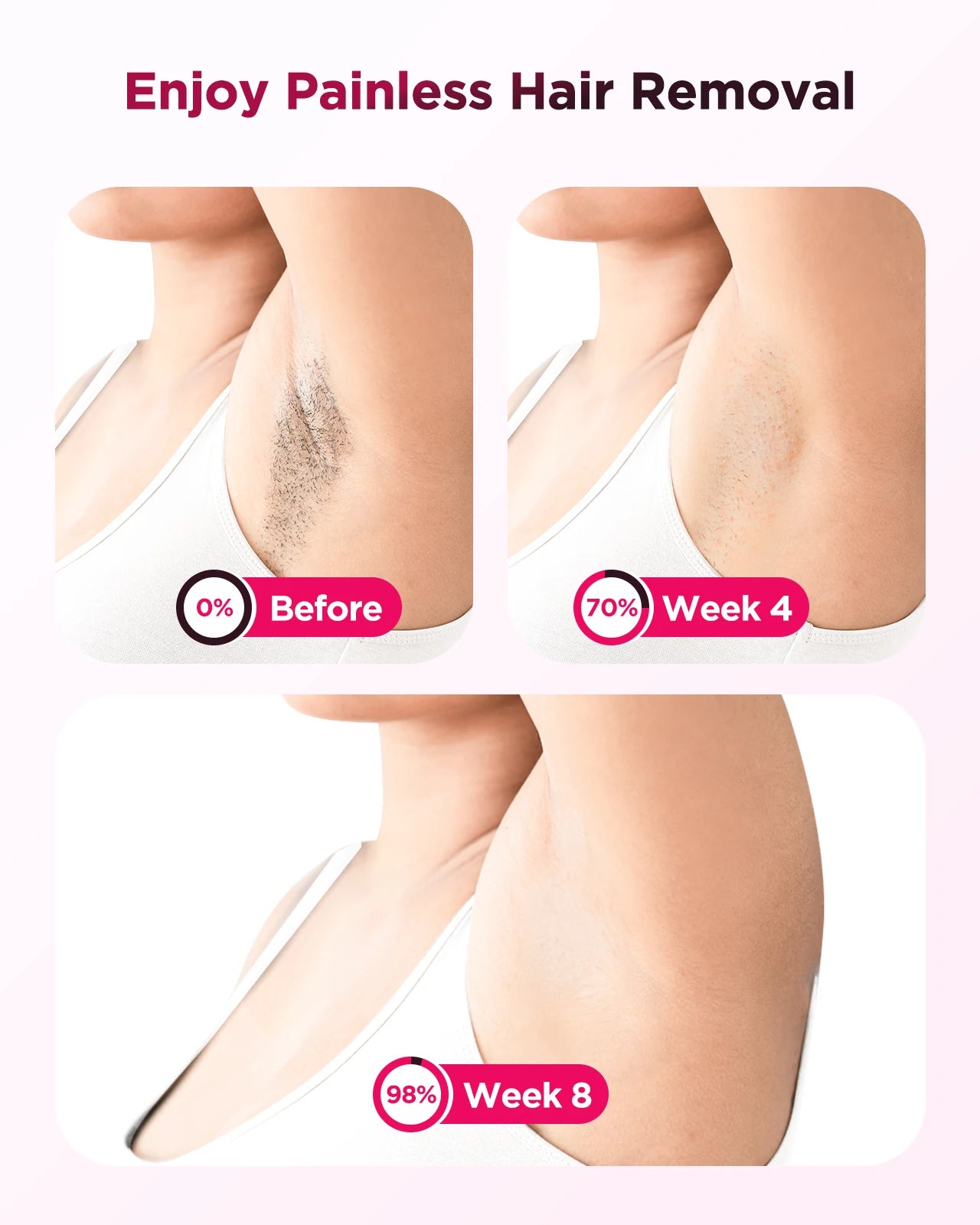LumiSkin Hair Removal